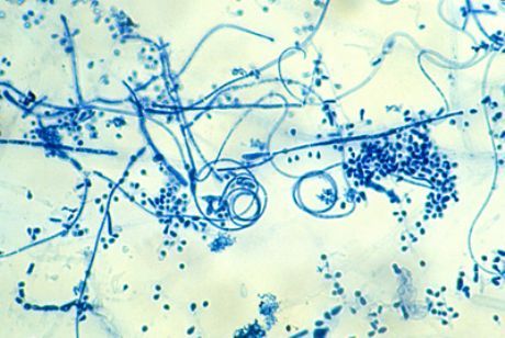 Czynnik sprawczy naskórkowej nóg (Trichophyton interdigitale)